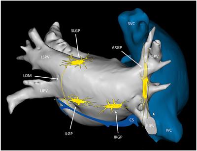 Cryoballoon ablation for atrial fibrillation: Effects on neuromodulation